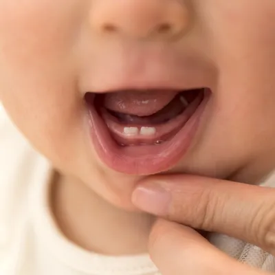 При прорезывании зубов у ребенка поднялась температура