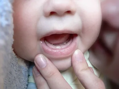 Сроки прорезывания молочных зубов | Блог Дарлин