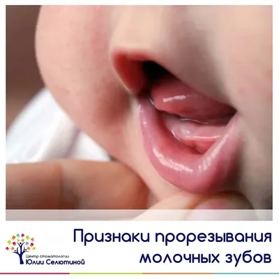 Как прорезываются зубы у детей и какие симптомы - советы стоматолога | РБК  Украина