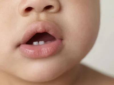 Каковы признаки прорезывания зубов у ребёнка? | Юлия Селютина | Дзен
