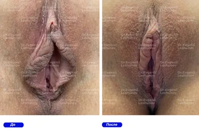 половые губы голых баб - ero-foto.fun