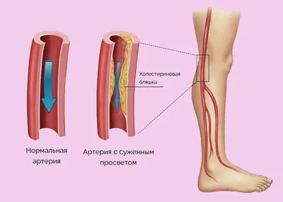 Виды дерматита, причины возникновения и общие симптомы | Балтмед