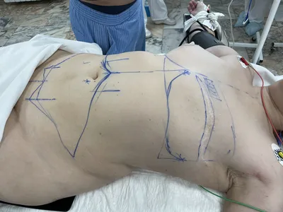 Выжившие. Судьбы женщин, удаливших грудь - РИА Новости, 24.10.2019