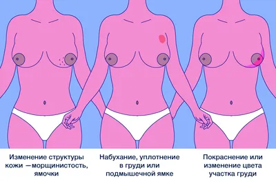Все идет изнутри»: как принять себя и сохранить сексуальность после  удаления груди