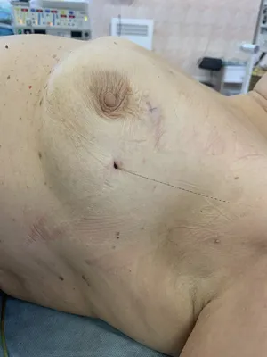 Лечение рака молочной железы в Южной Корее и Израиле