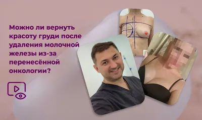 Белье для девушек после удаления груди: история GreenBra и GoodBra