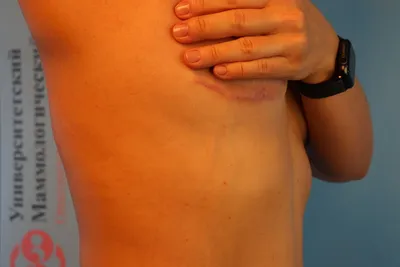 https://78.ru/articles/2024-02-07/rak-molochnih-zhelez-simptomi-diagnostika-faktori-riska-i-sovremennoe-lechenie-v-rossii