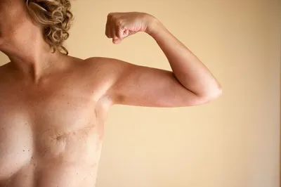 Как выглядит грудь после маммопластики | Клиника Доктора Росса