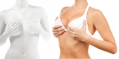 Увеличение груди: выбор имплантата - анатомические и круглые