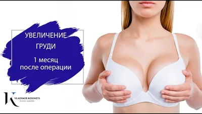 Увеличение груди имплантами: сколько длится операция, последствия и цена -  7Дней.ру