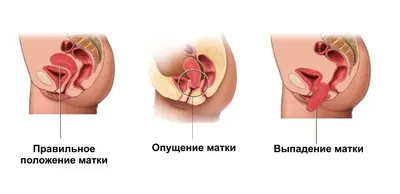 Идите… в Йони!»: одесская художница рисует женские половые органы (фото) |  Новости Одессы