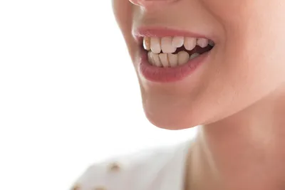 Капа после брекетов – цена, фото, отзывы на Startsmile.ru