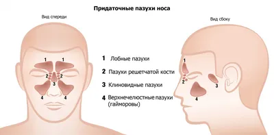 Лечение гайморита | Медицинский и диагностический центр в Лобне,  консультация врача в мед центре — Центр Современной Медицины