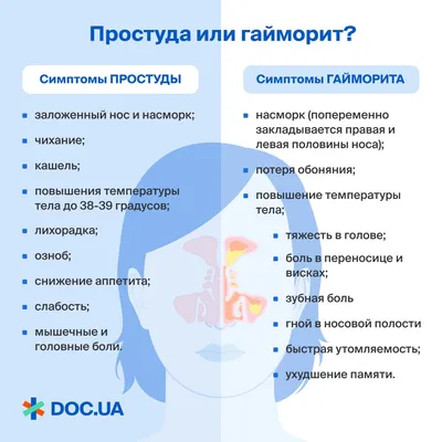 двусторонний острый гайморит | Портал радиологов