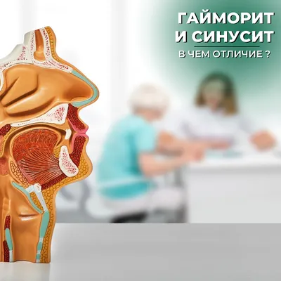 ᐈ 【Гайморит 】 | «Medisense» — клиника в Харькове, лучшие цены