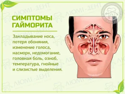 Фронтит+гайморит+пневмония