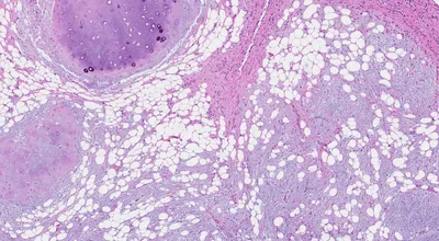 BI-RADS — исследование молочных желез — 24Radiology.ru