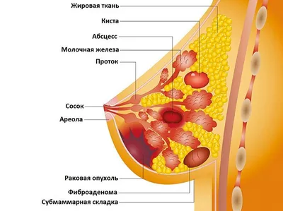 Маммография при раке молочной железы и для профилактики.