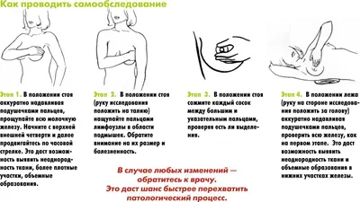 УЗИ молочной железы у детей (лекция на Диагностере) - Диагностер