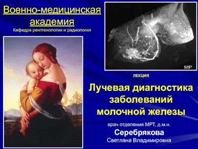 Реальные признаки рака молочной железы