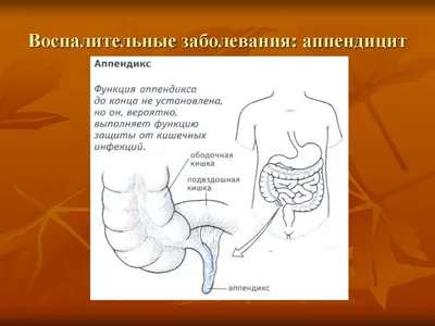 Аппендицит при беременности: чем это опасно и всегда ли проводят операцию |  О детском здоровье: с врачебного на родительский | Дзен