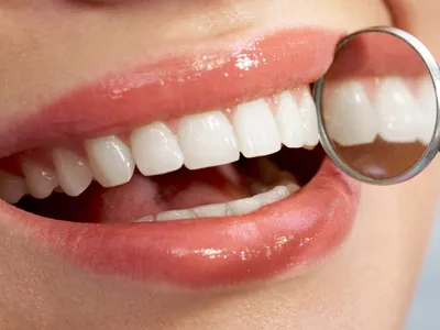 Реминерализация зубов в домашних условиях GC Tooth Mousse - \"Фортуна\"