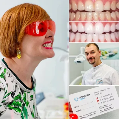 Лазерное отбеливание зубов в Минске, цена на лазерное отбеливание