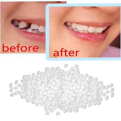 Косметическая реставрация зубов в Челябинске: цена эстетической  стоматологии от Dominanta74