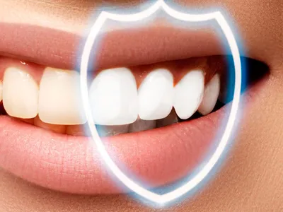 Купить Твердый зубной гель, материал для замены зубов, набор для ремонта  зубов, временный пломбировочный материал для зубов | Joom