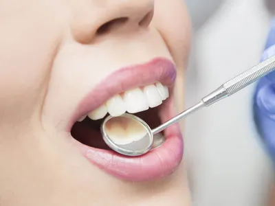 СЕНСИДЕНТ гель для снятия гиперчувствительности зубов 10мл Целит купить в  интернет-магазине NORMA.BIO