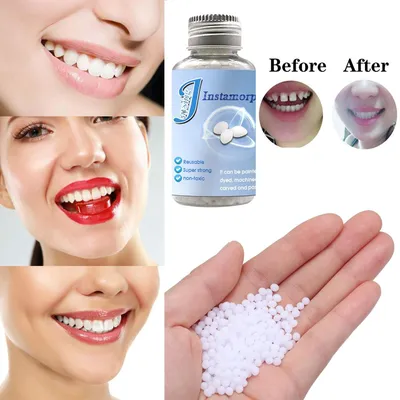 Твердый зубной гель, материал для замены зубов, набор для ремонта зубов,  временный пломбировочный материал для зубов – лучшие товары в  онлайн-магазине Джум Гик