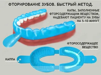 Отбеливание зубов