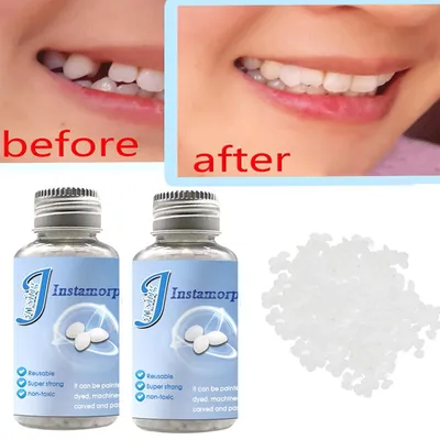 Твердый зубной гель, материал для замены зубов, набор для ремонта зубов,  временный пломбировочный материал для зубов – лучшие товары в  онлайн-магазине Джум Гик