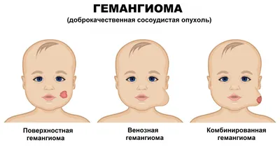 МРТ головного мозга при травмах головы | Клиника Эксперт