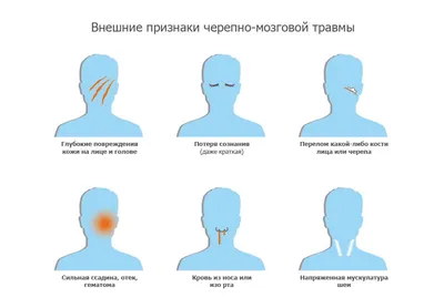 Субдуральная гематома на КТ и МРТ | Второе мнение