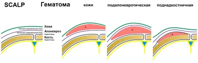 Женщина: Зона Отдыха - Что вам первым пришло в голову при виде этой  фотографии? ⠀ #фингал #синяк #синякподглазом #shiner #blackeye  #подбитыйглаз #жизненныеистории #мойопыт #мысливслух #я #женщина  #счастьеесть #вид #мое #утро #женскаягруппа #зонаотдыха ...