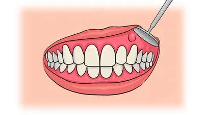 Прорезывание зубов : Температура, Сроки, Схема и Помощь