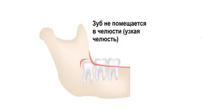 Схема прорезывания молочных зубов в материале экспертного журнала Startsmile