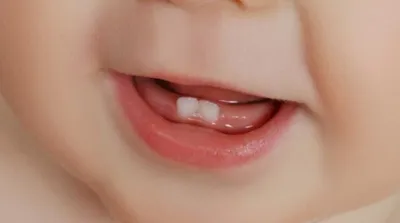 Прорезывание зубов у детей: когда появляются первые зубы — D.Ante