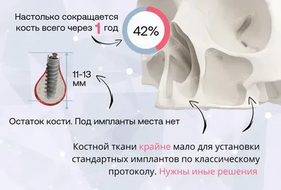 Желтоватое пятно на десне при прорезывании зуба? | форум Babyblog