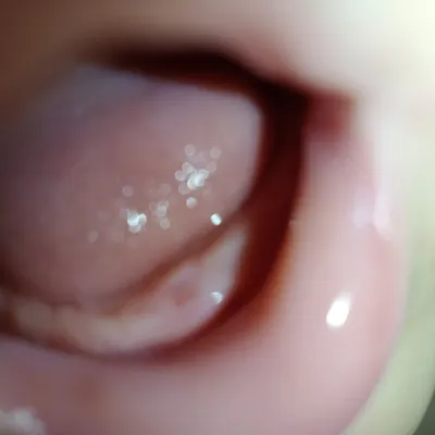 Прорезывание зубов у детей: гид для родителей