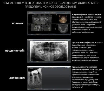 Не усложняйте! Немедленная имплантация или аугментация лунки?