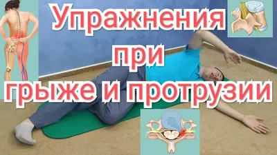 10 лучших упражнений при грыже поясничного отдела позвоночника: комплекс  эффективных тренировок для взрослых, чтобы предупредить или снять боль