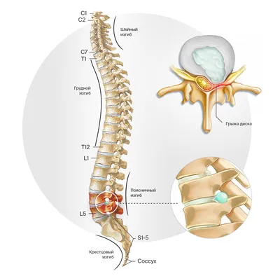 ОСОБЕННОСТИ ЗАНЯТИЙ ФИЗИЧЕСКОЙ КУЛЬТУРОЙ ПРИ ГРЫЖЕ ПОЗВОНОЧНИКА FEATURE