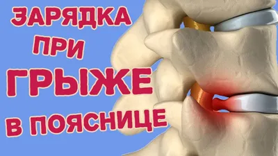 Остерегайтесь остеохондроза, если часто работаете за компьютером - Computer  Service Троещина