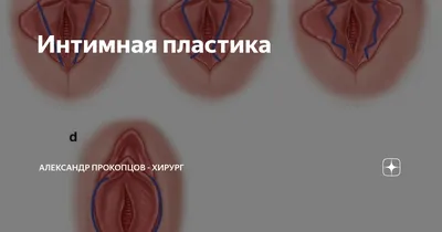 Нужна ли интимная пластика после родов?🤔 Далеко не всегда растянутые или  даже разорванные ткани возвращают свою исходную упругость.… | Instagram