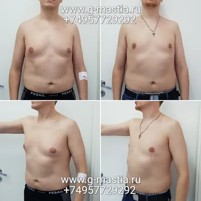 Результаты операций, фото до и после.