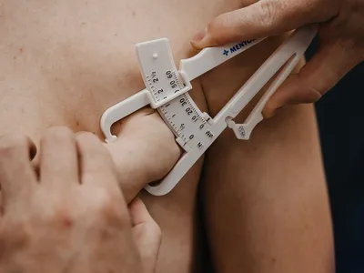 Лечение гинекомастии у мужчин в Ярославле с помощью операции в Клинике  «Константа»