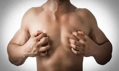 Что такое гинекомастия у мужчин. Причины, симптомы, последствия, методы  лечения | Хирург Щевцов - YouTube
