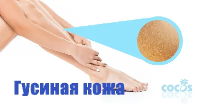 Все о гиперкератозе для мастера педикюра и клиента • Журнал NAILS